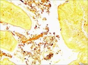 TTR006-25EA | HELICOBACTER TISSUE TROL TM CONTROL SLIDES FROM MO