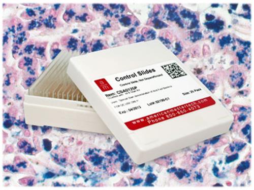 CSF0225P | Ferrif Iron Control slides, 25/pack