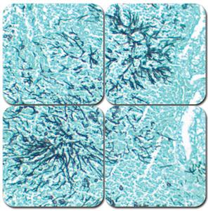 KTGMSPT | GMS Stain Kit, Pint