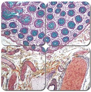 KTRMPPT | Russell-Movat Pentachrome Stain Kit, Pint