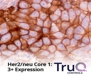 TRUQ-HER2-BLOCK | TRUQ HER2/NEU 3 CORE TMA CONTROL BLOCK, 1 EA