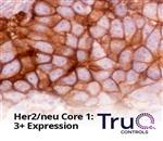 TRUQ-HER2-BLOCK | TRUQ HER2/NEU 3 CORE TMA CONTROL BLOCK, 1 EA