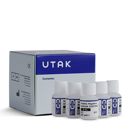 44511 | STABBS NEGATIVE