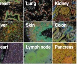 1000626 | Xenium Human Multi Tissue and Cancer Gene