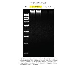 D4210 | Rapid spin-column purificaiton of transfection-grade plasmid DNA from up 5 ml of E. coli culture. 