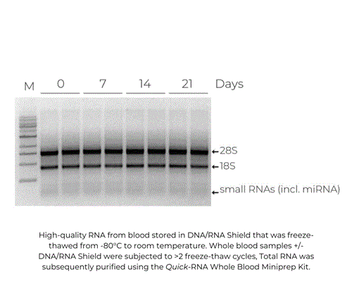 R1100-50 | The DNA/RNA Shield Reagent is a DNA and RNA stabilization solution and transport medium for any sample type. Get a free sample with free shipping.